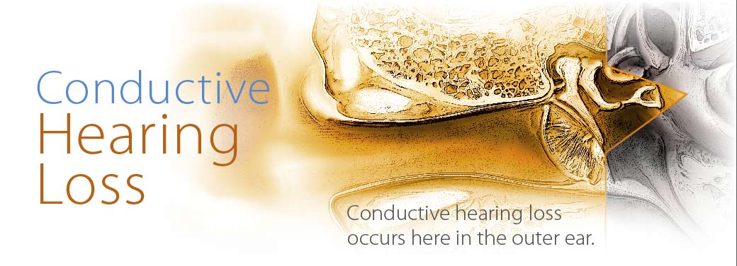 Conductive Hearing Loss | North State Audiological Services